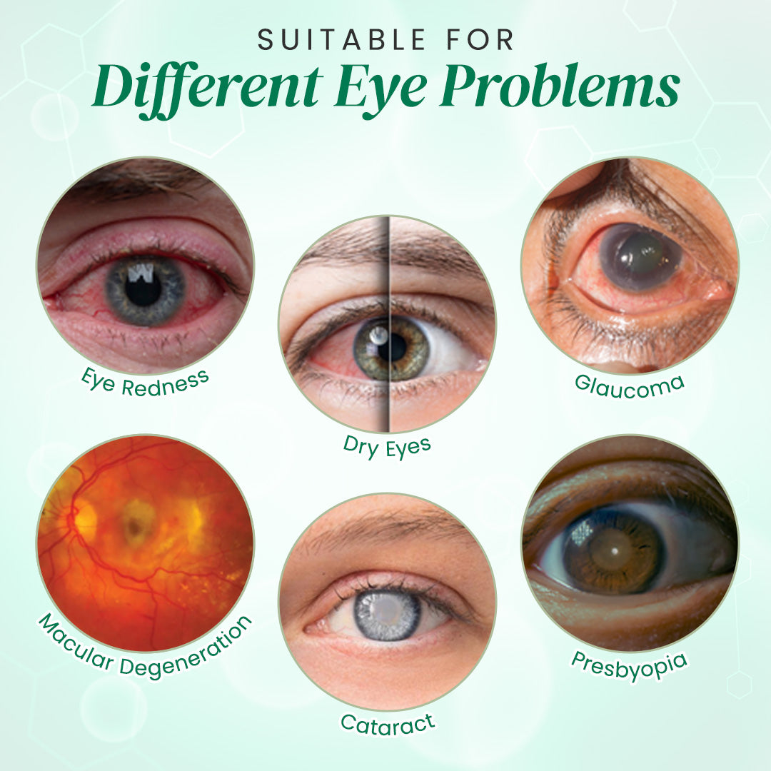 👩⚕️Seurico™ Nano Eye Drops Serum ✅Approved by the American Academy of Ophthalmology(Suitable for presbyopia, dry eye syndrome, glaucoma, and cataracts)