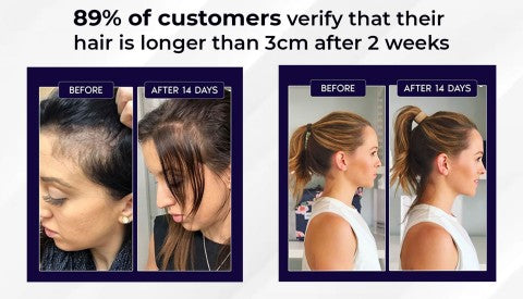 🌿 Odeiun™ Natural Hair Regrowth Spray – Naturally regrow fuller hair and restore your confidence