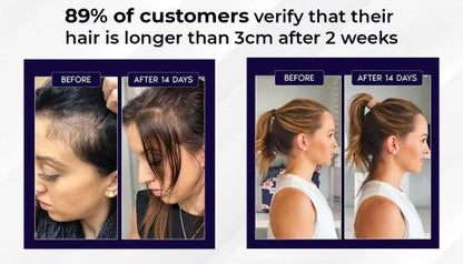 🌿 Odeiun™ Natural Hair Regrowth Spray – Naturally regrow fuller hair and restore your confidence