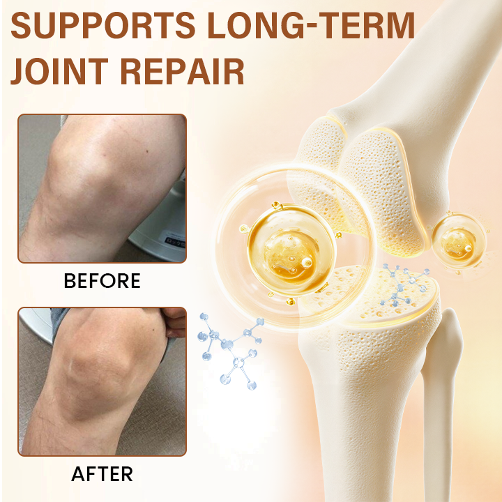Seurico™ Joint Comfort Spray – FDA-Approved Fast Relief & Mobility Support