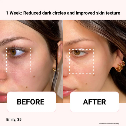 Odeiun™ Vegan Collagen Firming Eye Serum | Luxurious Anti-Aging Care from Korea