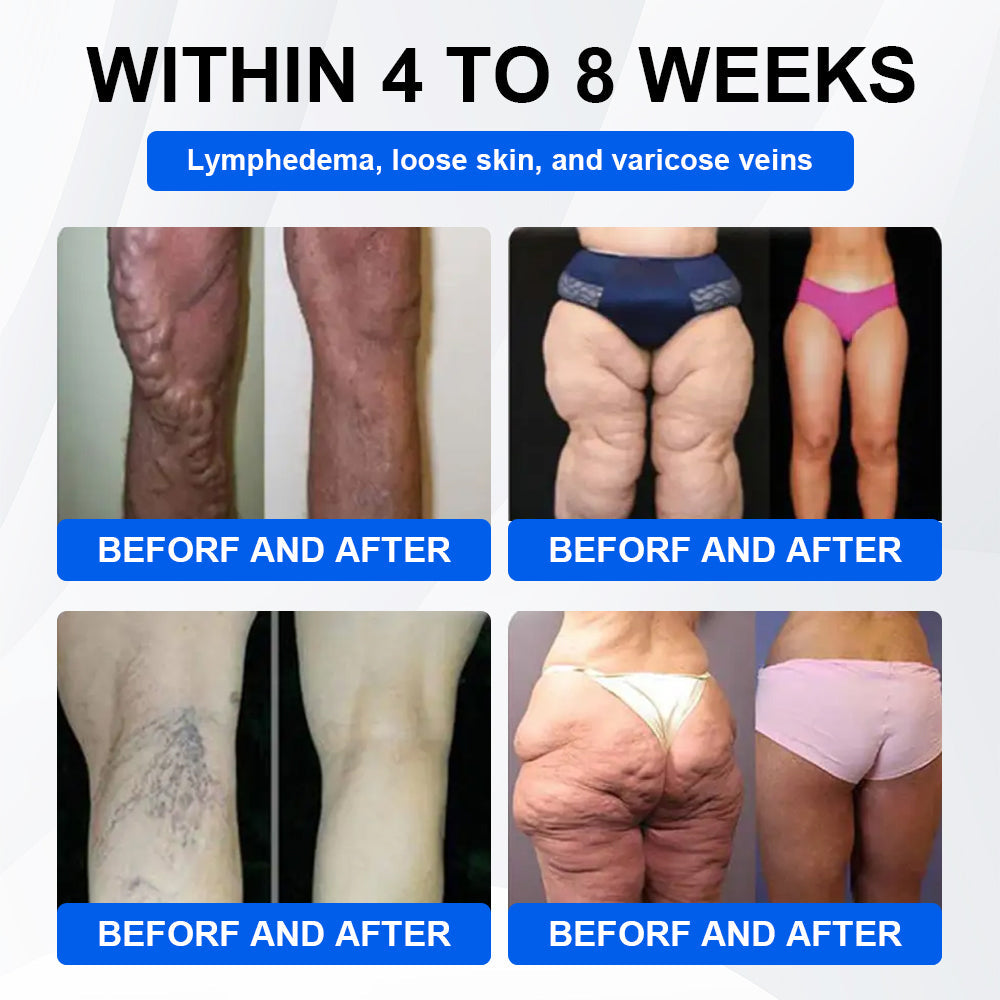 🔥Official Store | LBMLBM® SMGT-GLP-1 Nano Microneedle Patch with Collagen & Motrixyl 3000 | Targeting Obesity, Cardiovascular Disease, Diabetes, Sleep Apnea, Joint Issues & More