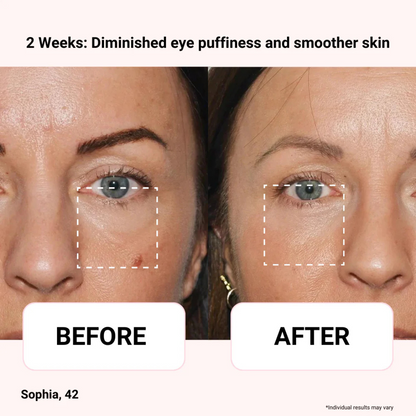 Odeiun™ Vegan Collagen Firming Eye Serum | Luxurious Anti-Aging Care from Korea