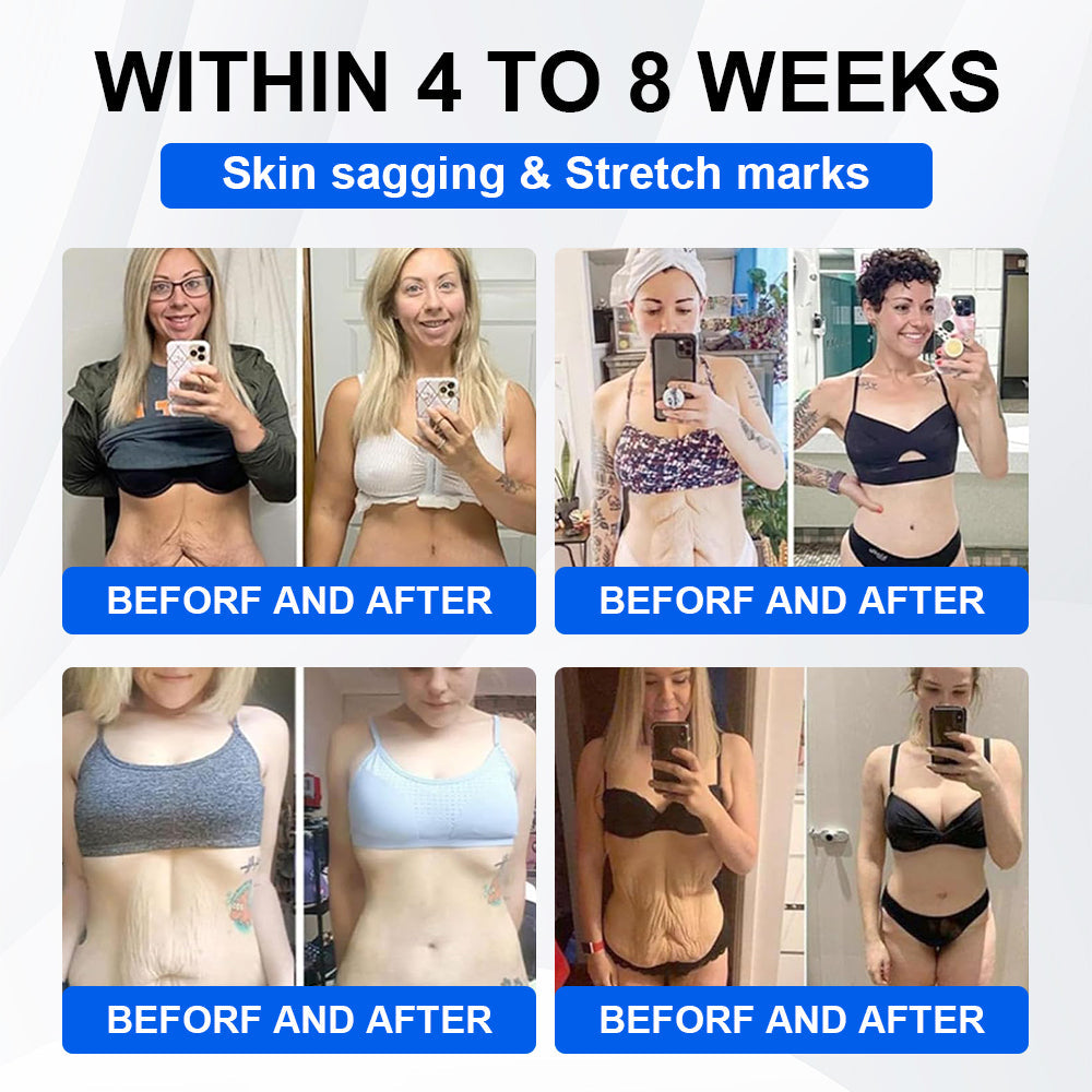 🔥Official Store | LBMLBM® SMGT-GLP-1 Nano Microneedle Patch with Collagen & Motrixyl 3000 | Targeting Obesity, Cardiovascular Disease, Diabetes, Sleep Apnea, Joint Issues & More