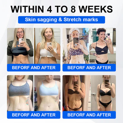 🔥Official Store | LBMLBM® SMGT-GLP-1 Nano Microneedle Patch with Collagen & Motrixyl 3000 | Targeting Obesity, Cardiovascular Disease, Diabetes, Sleep Apnea, Joint Issues & More