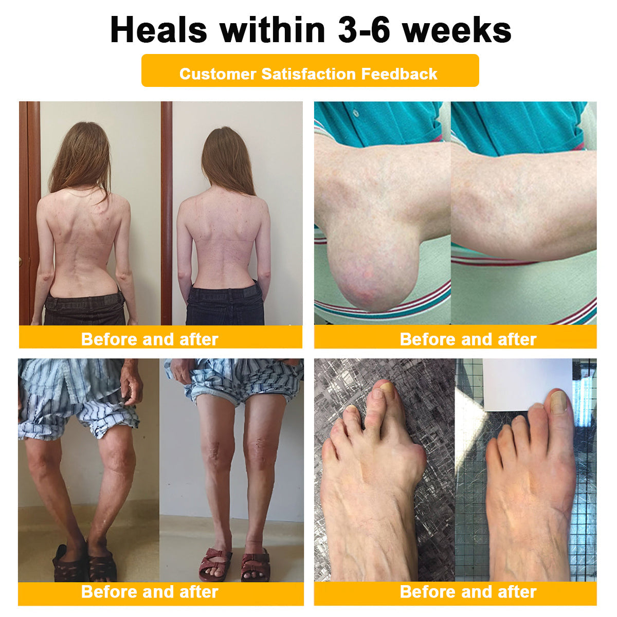 🎁Flash Sale - ODALIT™ Botulinum Toxin & Bee Venom Pain-Relief Bone Healing Cream)