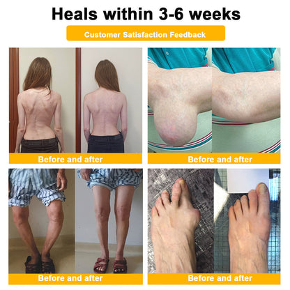 🎁Flash Sale - ODALIT™ Botulinum Toxin & Bee Venom Pain-Relief Bone Healing Cream)