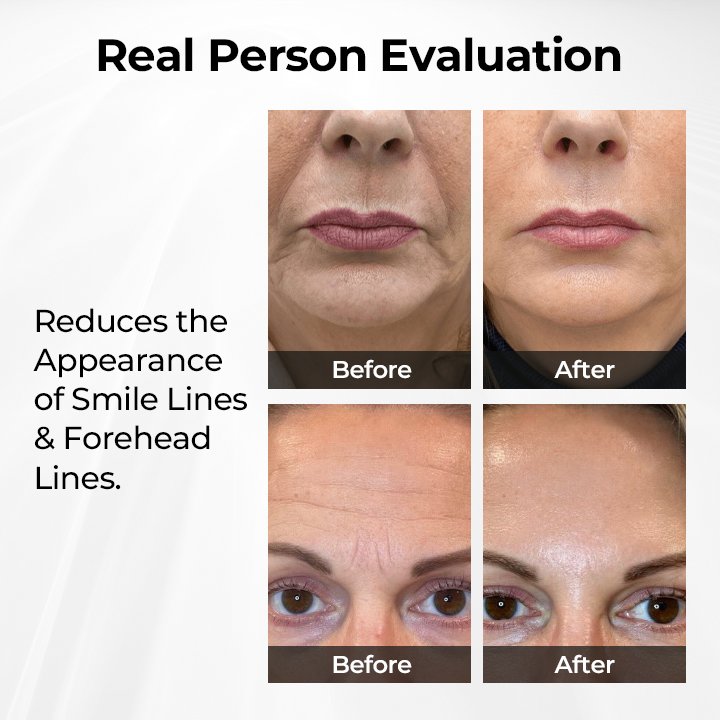 ✨ ODEIUN™ TightShift Precision Contour & Firming Serum 💧 | Advanced Skin Sculpting & Lifting Formula