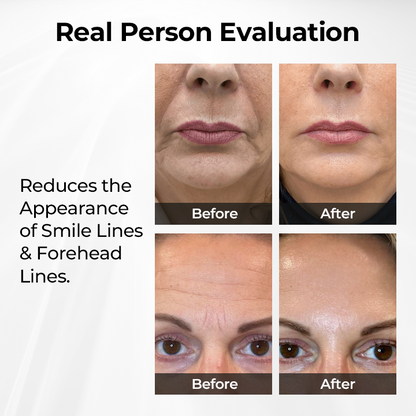 ✨ ODEIUN™ TightShift Precision Contour & Firming Serum 💧 | Advanced Skin Sculpting & Lifting Formula