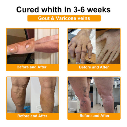 🎁Flash Sale - ODALIT™ Botulinum Toxin & Bee Venom Pain-Relief Bone Healing Cream)