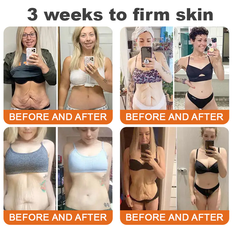 🏆Seurico™ Instant Wrinkle-Free Bee Toxin Cream | FINAL HOURS – 80% FLASH SALE!