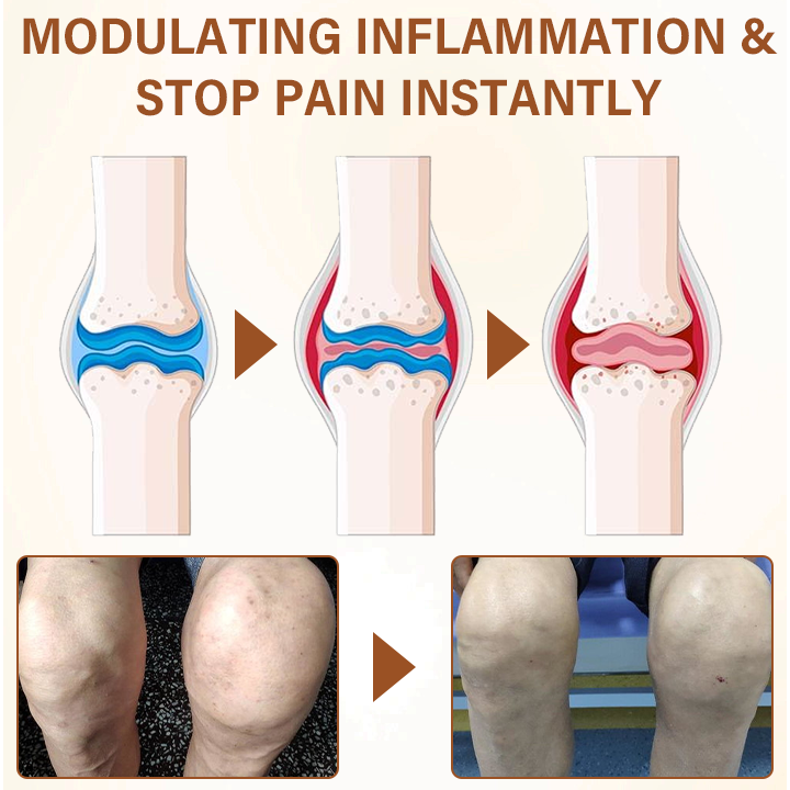 Seurico™ Joint Comfort Spray – FDA-Approved Fast Relief & Mobility Support