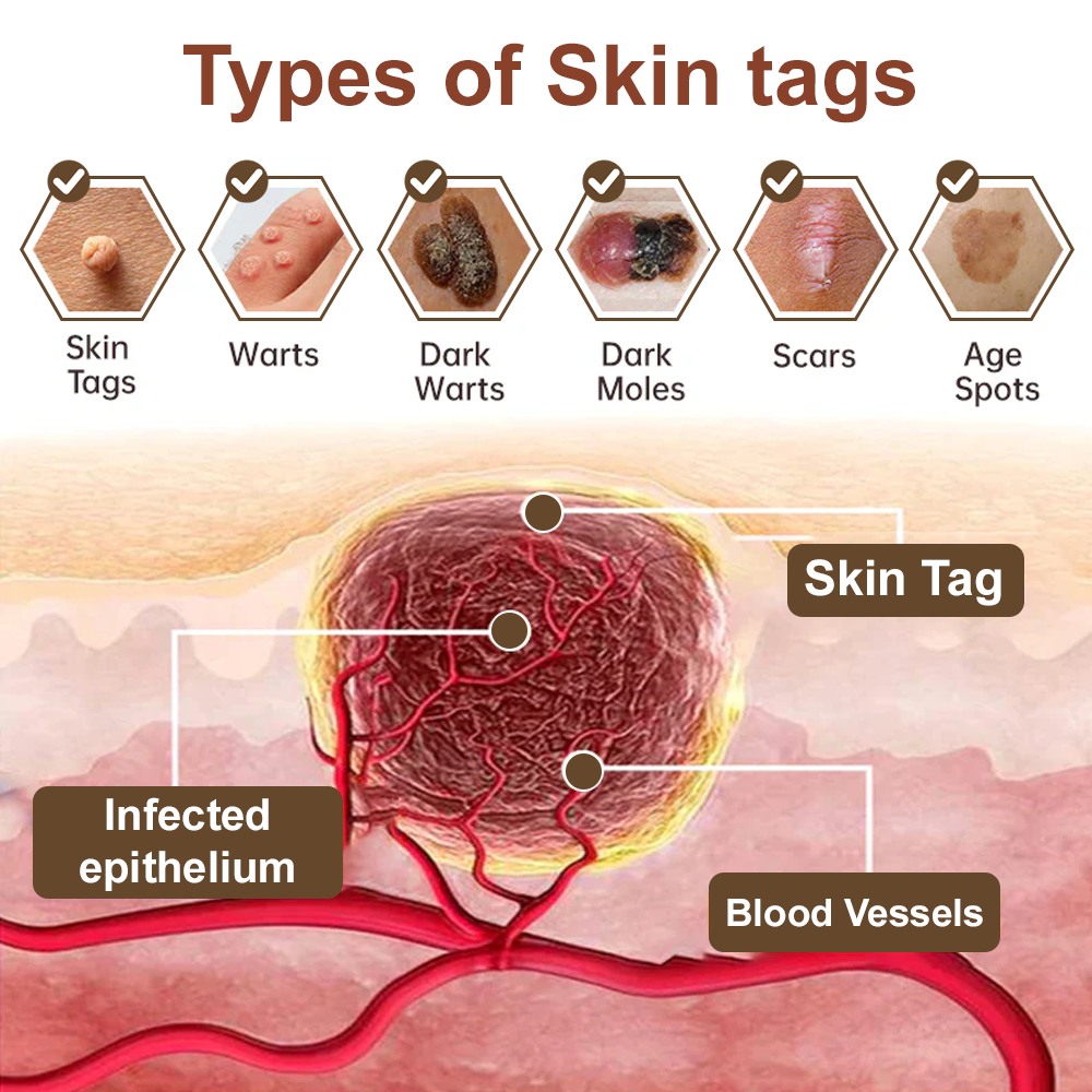 Seurico™ Black Rice Skin Repair Cream ⚕️ FDA Certified – Targets Warts, Psoriasis & Pigmentation