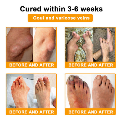 🎁Flash Sale - Seurico™ Botulinum Toxin & Bee Venom Pain-Relief Bone Healing Cream