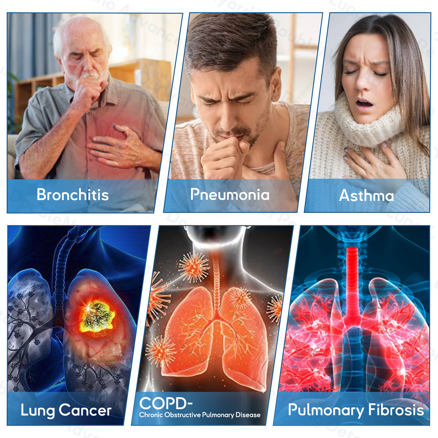 👑👑👑👑Official Store: ODEIUN™ DoubleNano Advanced Lung Detox Relief Patch