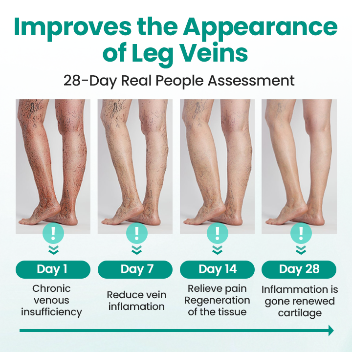 Seurico™ VeinRevive Leg Varicosity Treatment Patch
