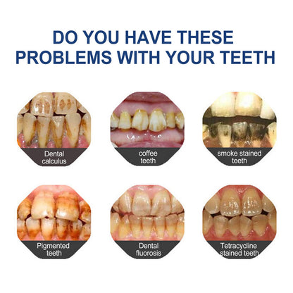 🔥 Final Day 60% OFF 🔥Odalt™- Fluoride-Free Hydroxyapatite Toothpaste