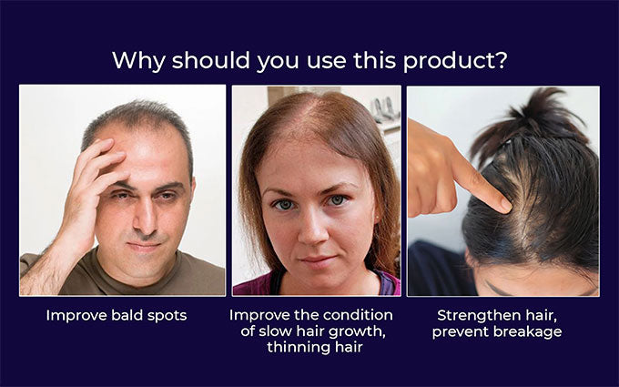 🌿 Odeiun™ Natural Hair Regrowth Spray – Naturally regrow fuller hair and restore your confidence