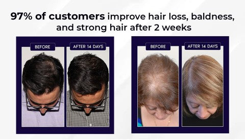 🌿 Odeiun™ Natural Hair Regrowth Spray – Naturally regrow fuller hair and restore your confidence