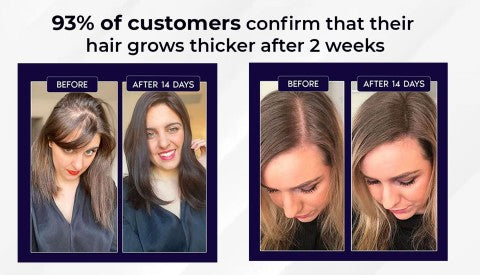 🌿 Odeiun™ Natural Hair Regrowth Spray – Naturally regrow fuller hair and restore your confidence