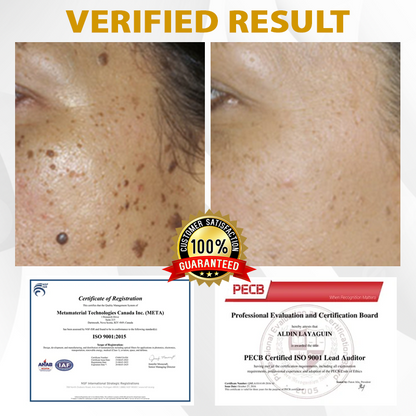 【🔥Last Day Promotion 45% OFF⚡】Seurico™ CastorBee Tag & Spots Peel-Off Mask