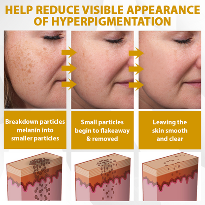 【🔥Last Day Promotion 45% OFF⚡】Seurico™ CastorBee Tag & Spots Peel-Off Mask