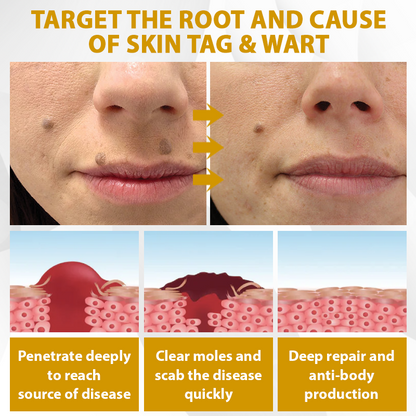 【🔥Last Day Promotion 45% OFF⚡】Seurico™ CastorBee Tag & Spots Peel-Off Mask