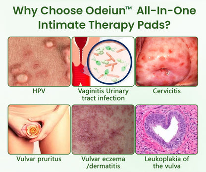 ODEIUN™ FeminaDefend All-In-One Intimate Therapy Pads