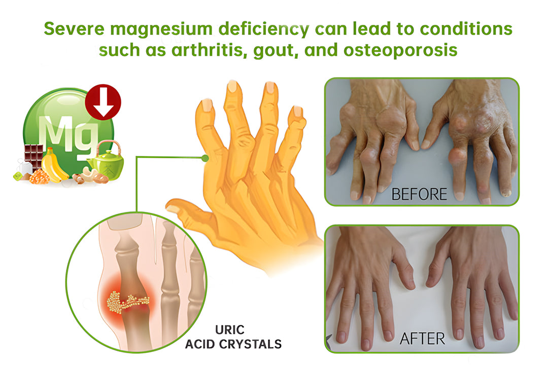 🎁NEGUSY™ Magnesium & Peppermint Arthritis & Bone Healing Cream – Fast Pain Relief & Joint Support