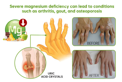 🎁NEGUSY™ Magnesium & Peppermint Arthritis & Bone Healing Cream – Fast Pain Relief & Joint Support