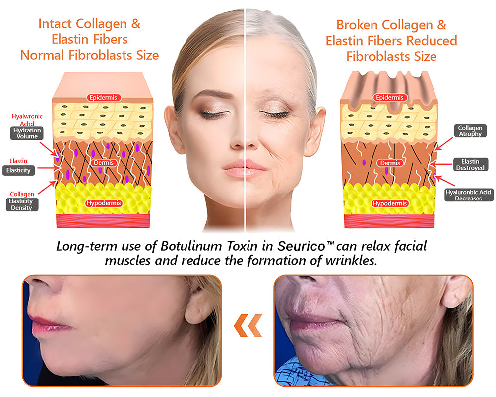 🏆Seurico™ Instant Wrinkle-Free Bee Toxin Cream | FINAL HOURS – 80% FLASH SALE!