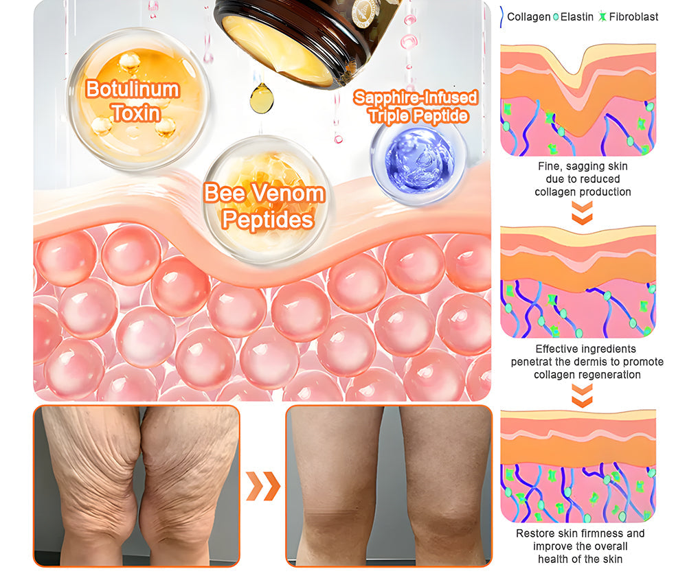 🏆Seurico™ Instant Wrinkle-Free Bee Toxin Cream | FINAL HOURS – 80% FLASH SALE!