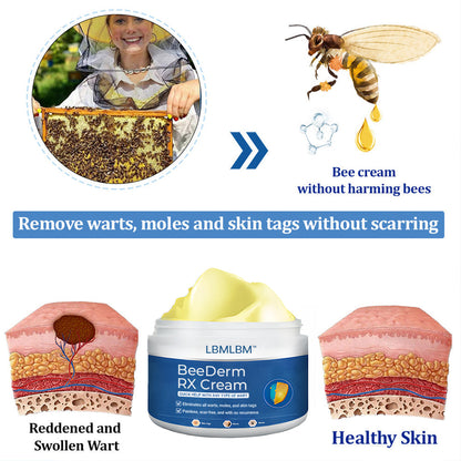 👩‍⚕️LBMLBM™ BeeDerm RX Cream, Painless, easy and gentle fix for warts, skin tags, lumps, infections, cysts and scars