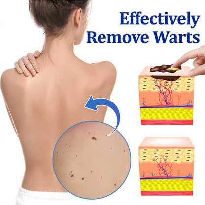 👩‍⚕️LBMLBM™ BeeDerm RX Cream, Painless, easy and gentle fix for warts, skin tags, lumps, infections, cysts and scars