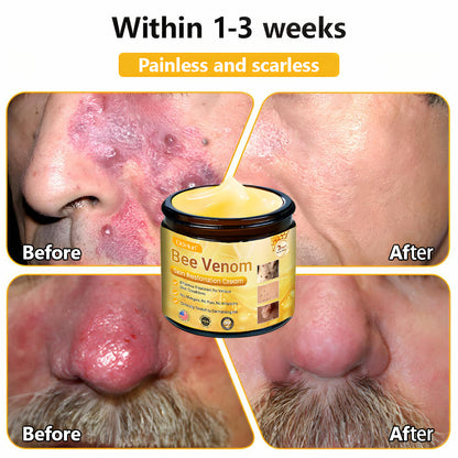 ✨ ODEIUN™ Bee Venom Skin Restoration Cream - Revitalize & Renew Your Skin Naturally! 🌿🐝