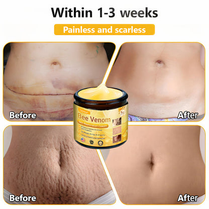 ✨ ODEIUN™ Bee Venom Skin Restoration Cream - Revitalize & Renew Your Skin Naturally! 🌿🐝