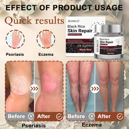 Seurico™ Black Rice Skin Repair Cream ⚕️ FDA Certified – Targets Warts, Psoriasis & Pigmentation