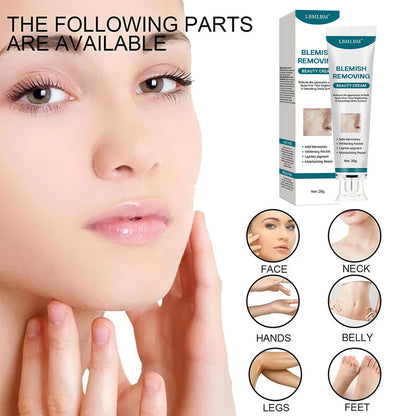 ✨ [Official Store] LBMLBM™ Blemish Removing Beauty Cream – Fade Dark Spots, Freckles & Wrinkles 💫 Restore a Radiant, Even-Toned Glow!