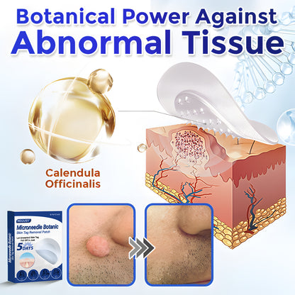 ✅Negusy™ MicroNeedle Botanic Skin Tag Removal Patches – 🇺🇸 Made in the USA | Fast, Painless, Plant-Powered