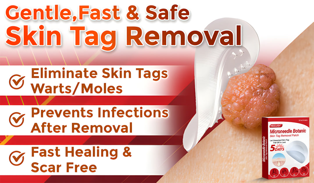 Negusy™ MicroNeedle Botanic Skin Tag Removal Patches – 🇺🇸 Made in the USA | Fast, Painless, Plant-Powered