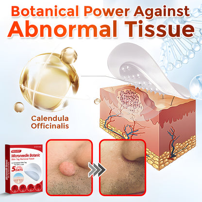 Negusy™ MicroNeedle Botanic Skin Tag Removal Patches – 🇺🇸 Made in the USA | Fast, Painless, Plant-Powered