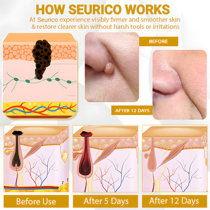 【🔥Last Day Promotion 45% OFF⚡】Seurico™ CastorBee Tag & Spots Peel-Off Mask