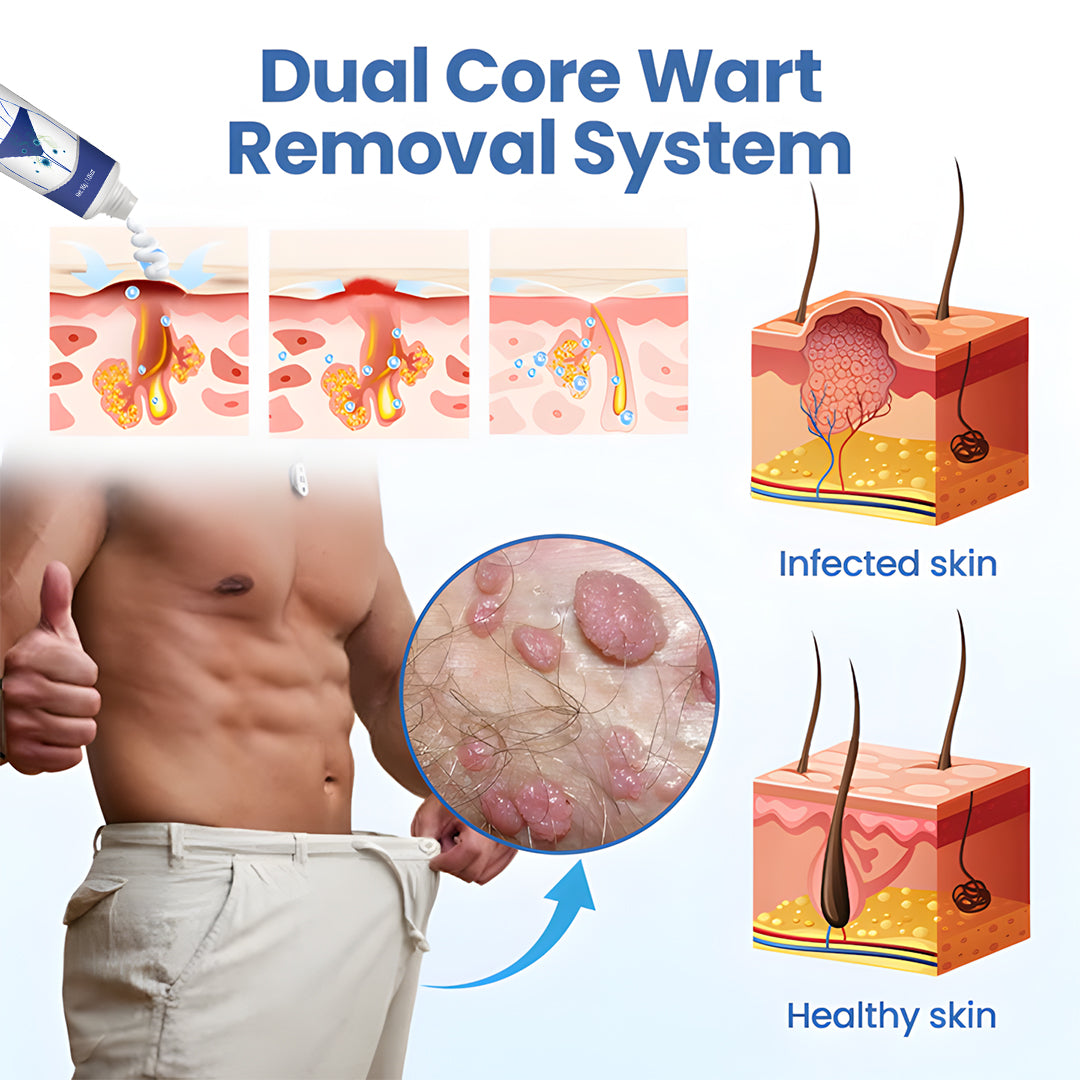 🌿 ODEIUN™ WartClear Treatment Cream — Deep Penetration, Gentle Removal of Genital Warts