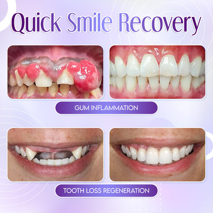 TeethRestoration Mineral Powder🦷(ADA recommended) 🎁Flash Sale - Don’t Miss Out