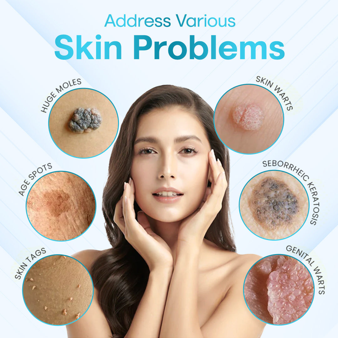 ✅ ODEIUN™ Professional Mole Removal Serum – Trusted Dermatological Formula 🩺