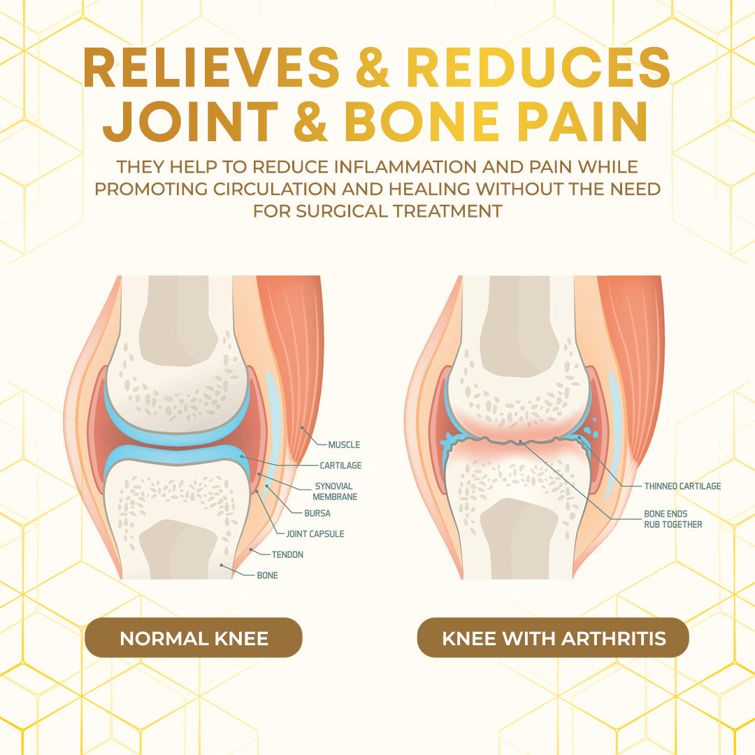Seurico™ Bee Venom Joint Therapy Pain Relief Gel🐝🔥