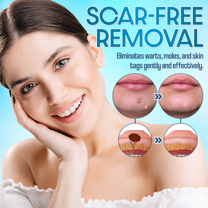✨Seurico™ Laser Pen - Non-invasive Mole and Wart Removal