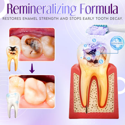 TeethRestoration Mineral Powder🦷(ADA recommended) 🎁Flash Sale - Don’t Miss Out