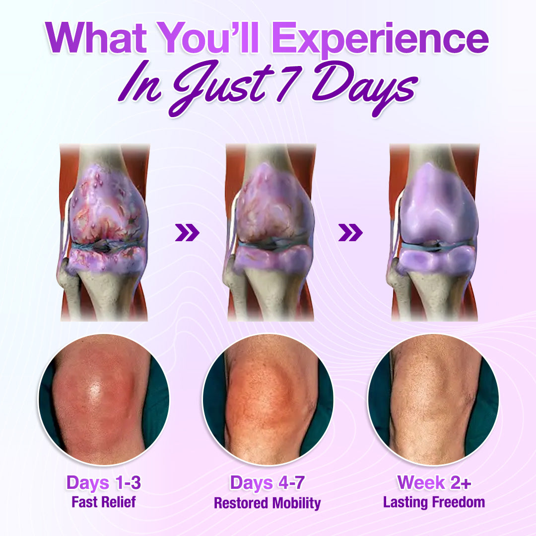 Seurico™ Joint Rescue Gel – Fast 7-Day Relief for Stiff & Aching Joints