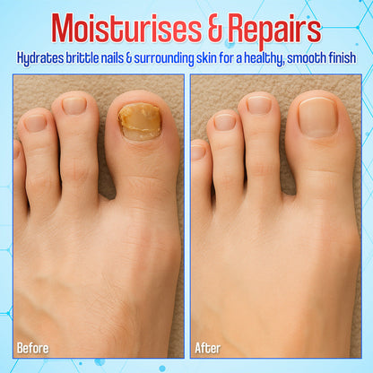 Zakdavi™ Anti-Fungal Nail Repair Patches — Say Goodbye to Nail Fungus in Days! 💅